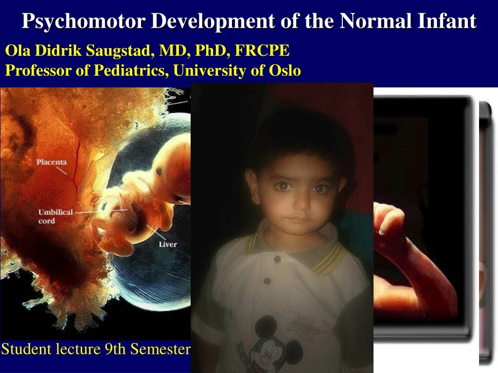 psychomotor development of the normal infant