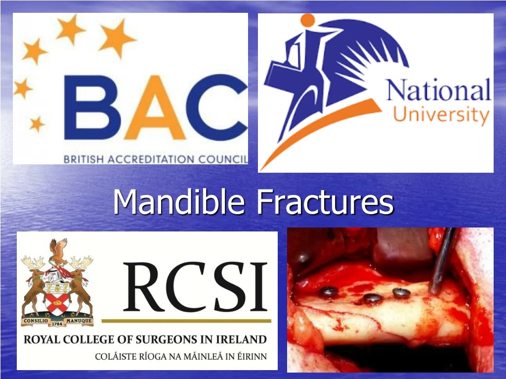 mandible fractures