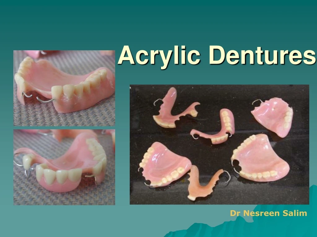 PPT Acrylic Dentures PowerPoint Presentation Free Download ID 9236302 PPT Acrylic Dentures PowerPoint Presentation Free Download ID 9236302