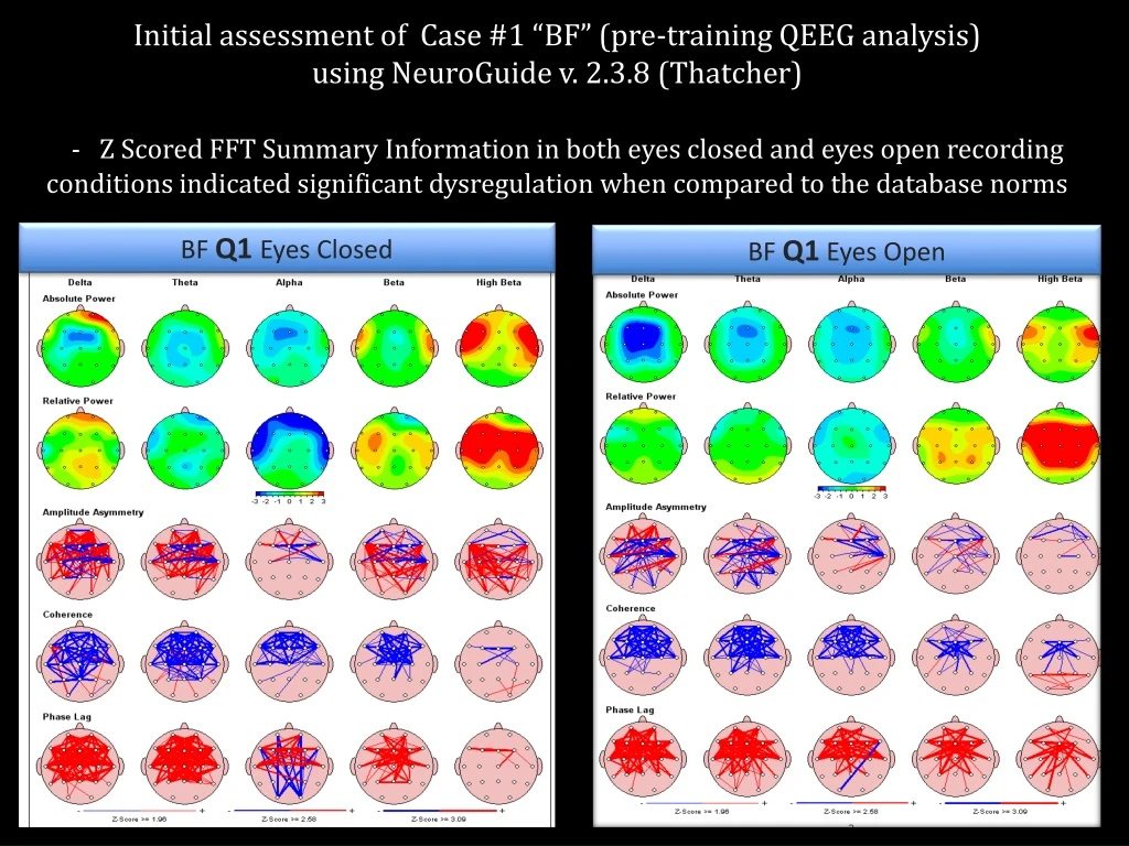 initial assessment of case 1 bf pre training qeeg