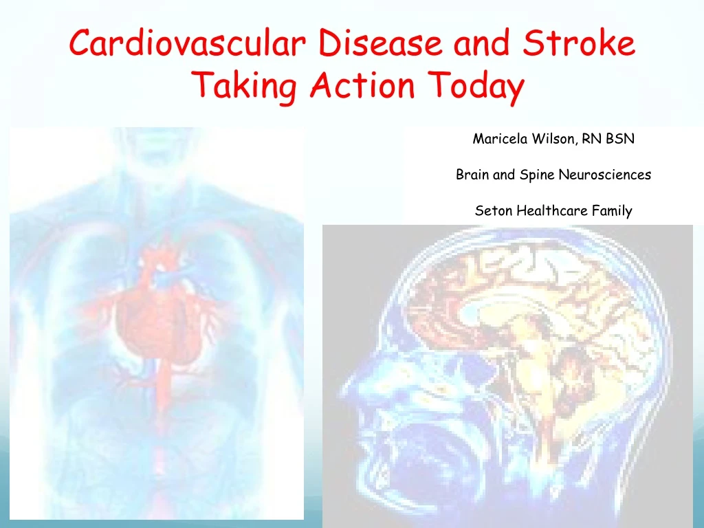 cardiovascular disease and stroke taking action today