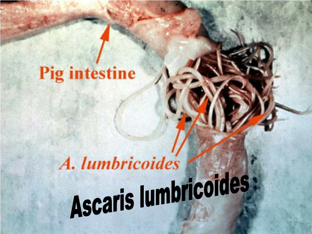 ascaris lumbricoides