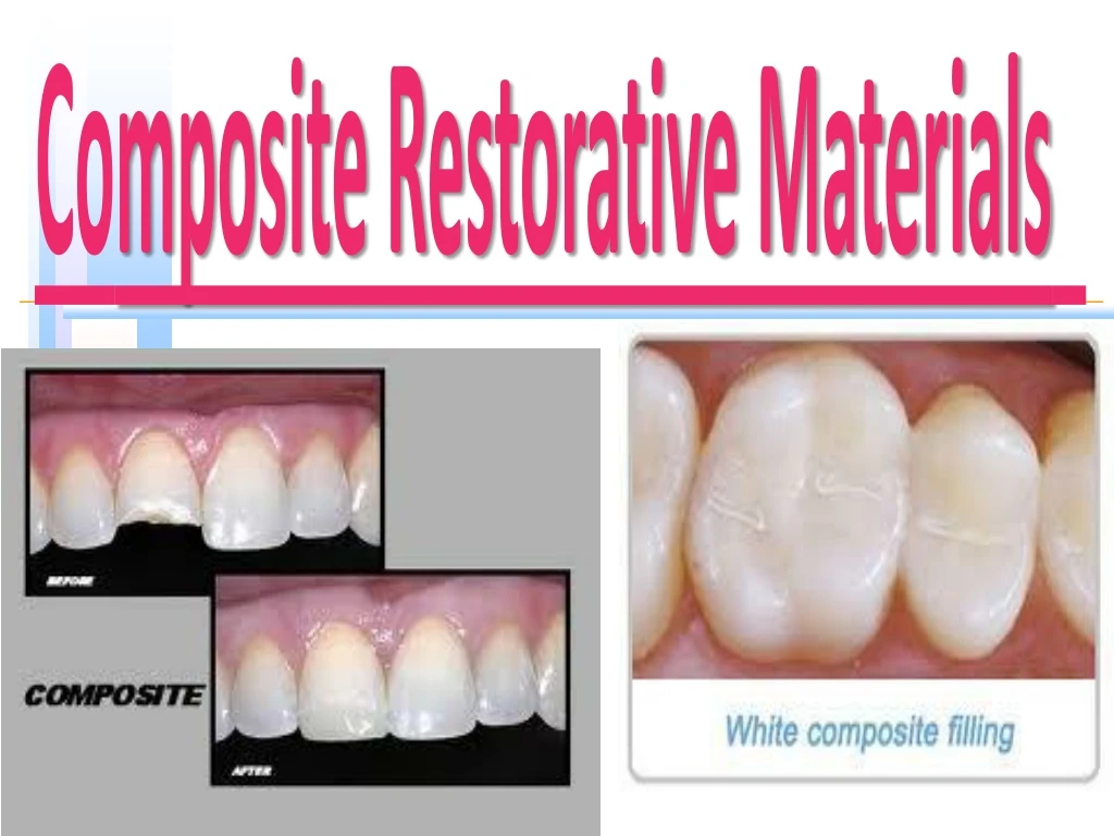 co mposite restorative materials
