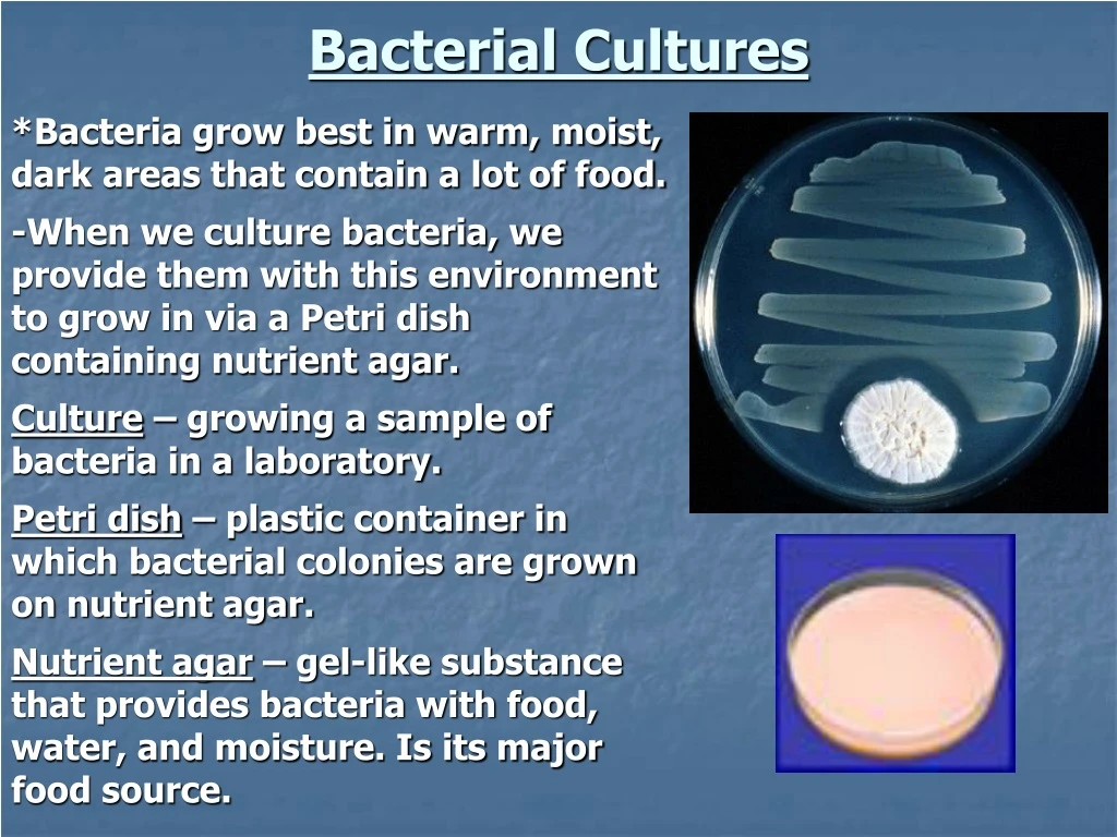 bacterial cultures