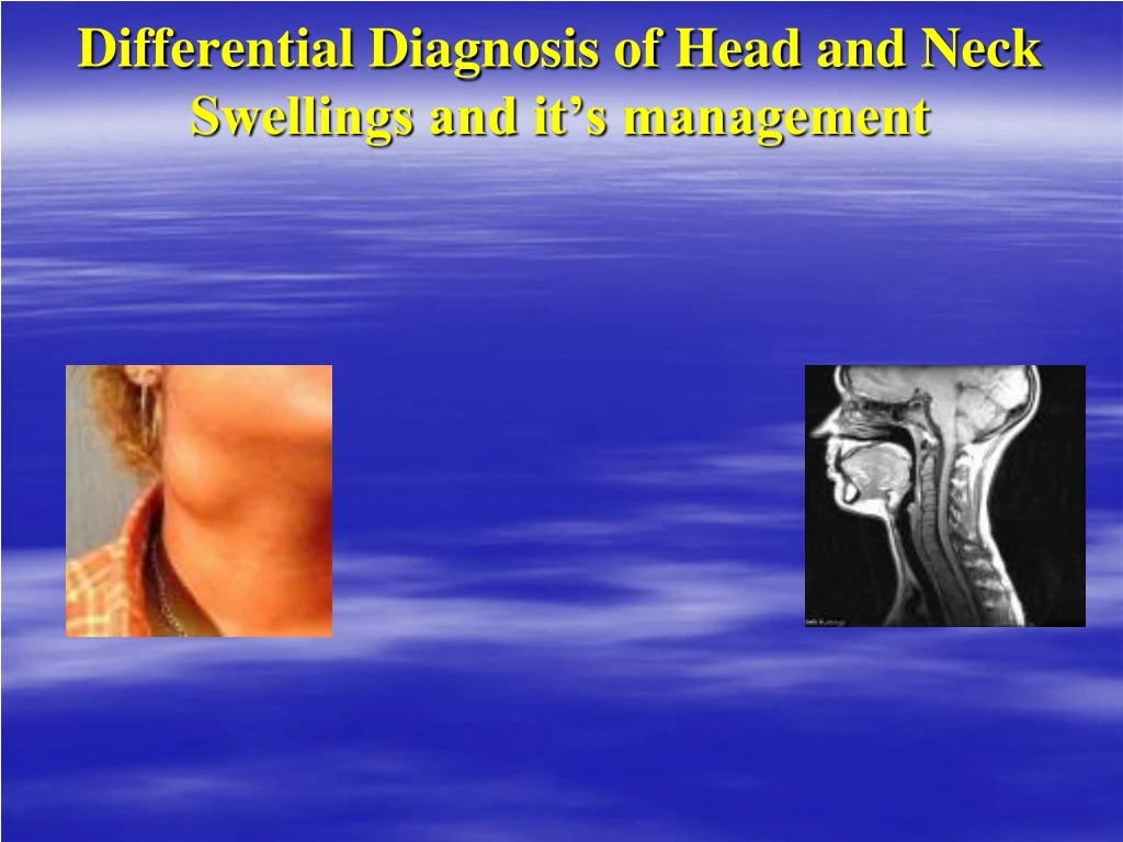 differential diagnosis of head and neck swellings and it s management