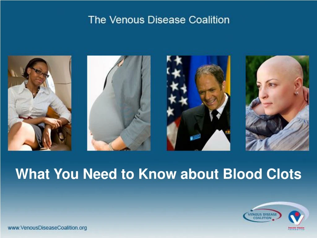 what you need to know about blood clots