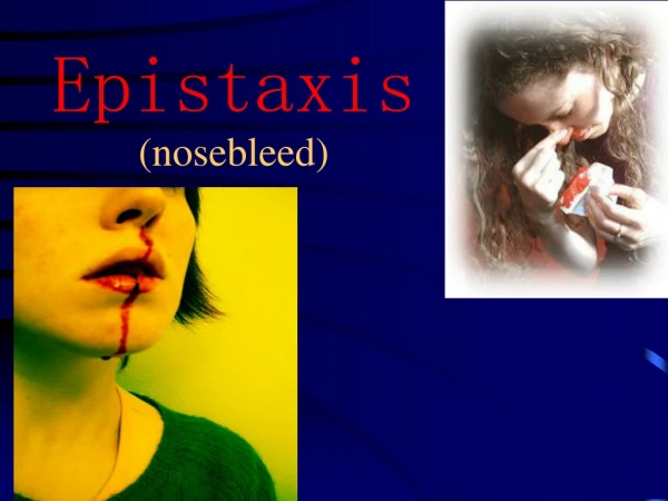 Epistaxis (nosebleed)
