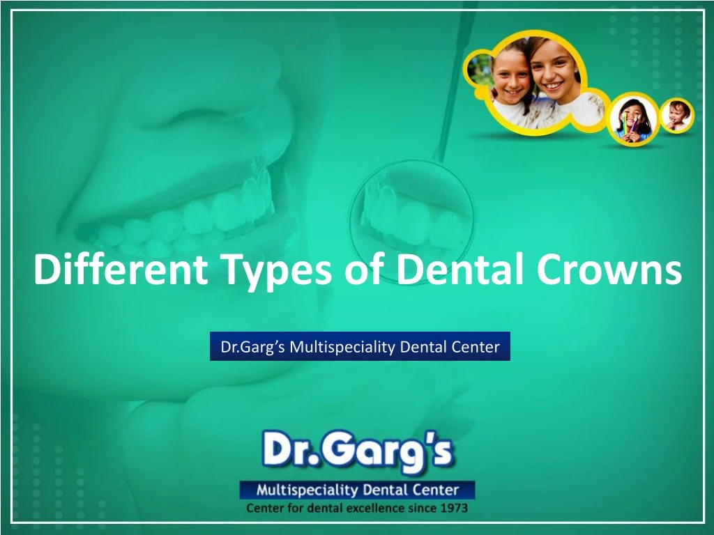 different types of dental crowns