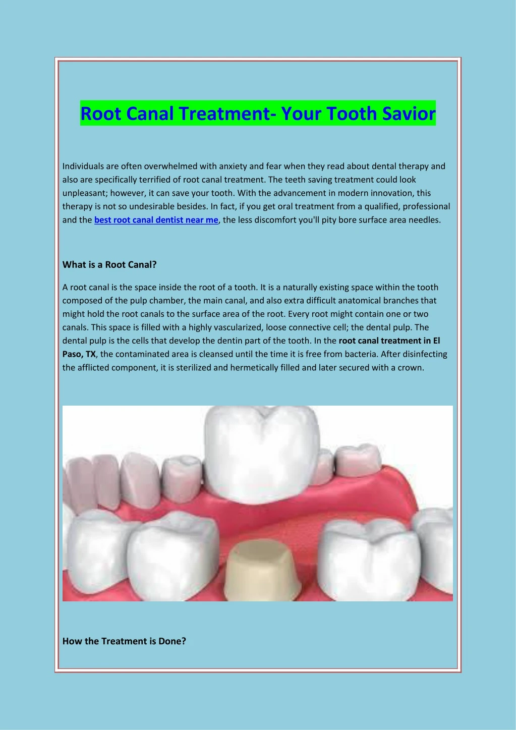 root canal treatment your tooth savior