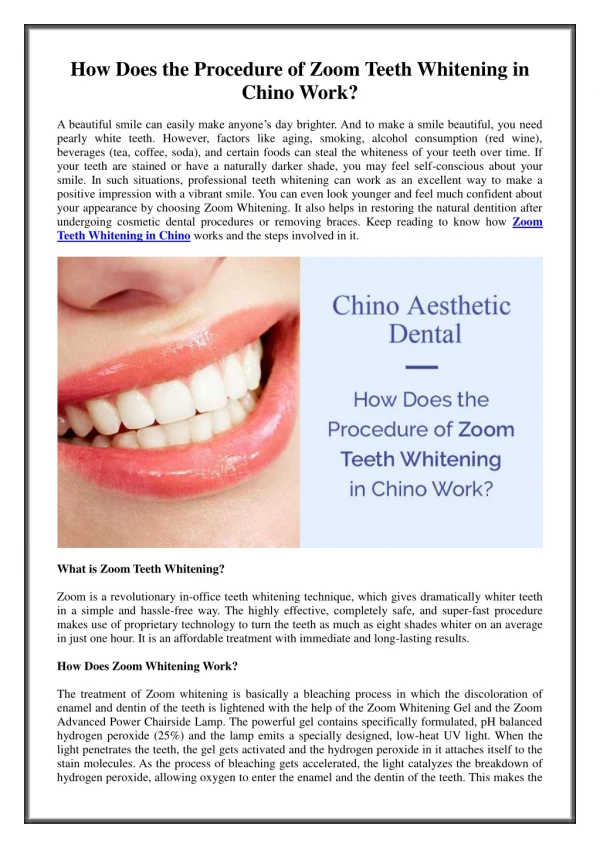 How Does the Procedure of Zoom Teeth Whitening in Chino Work?