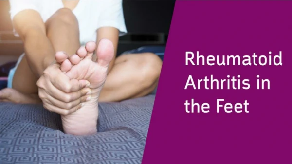 Rheumatoid Arthritis in the Feet- What to Know?