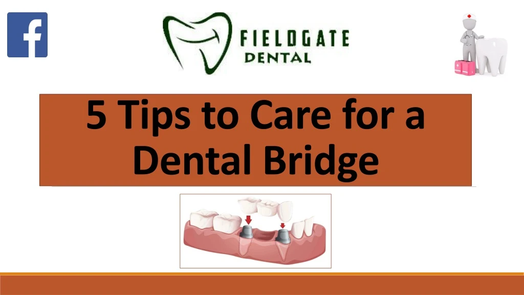 5 tips to care for a dental bridge