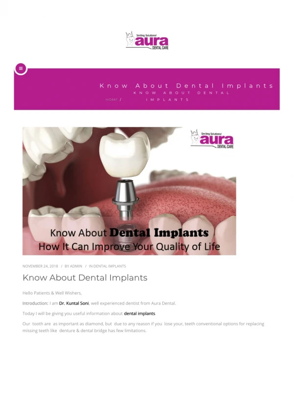 Know About Dental Implants How It Can Improve Your Quality of Life
