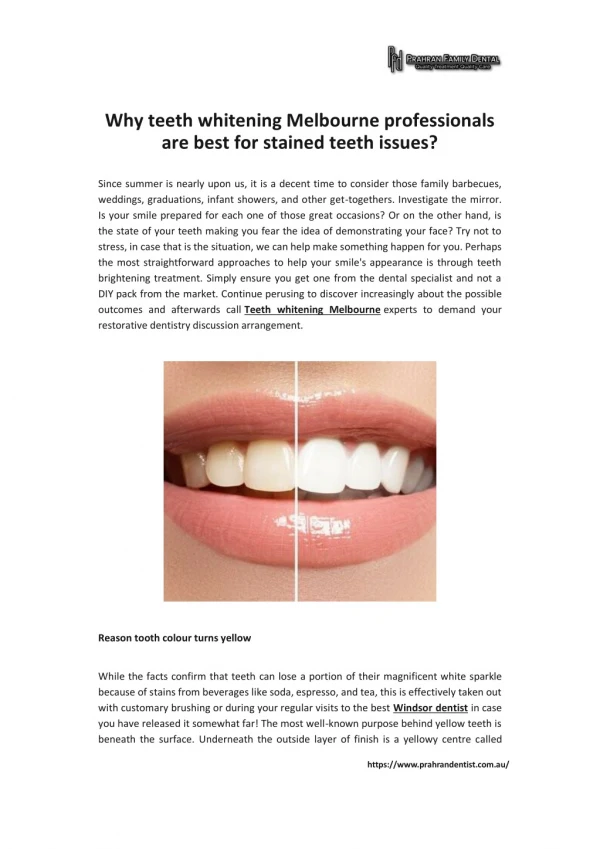 Why teeth whitening Melbourne professionals are best for stained teeth issues?
