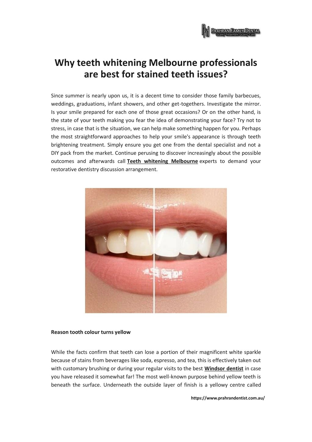 why teeth whitening melbourne professionals