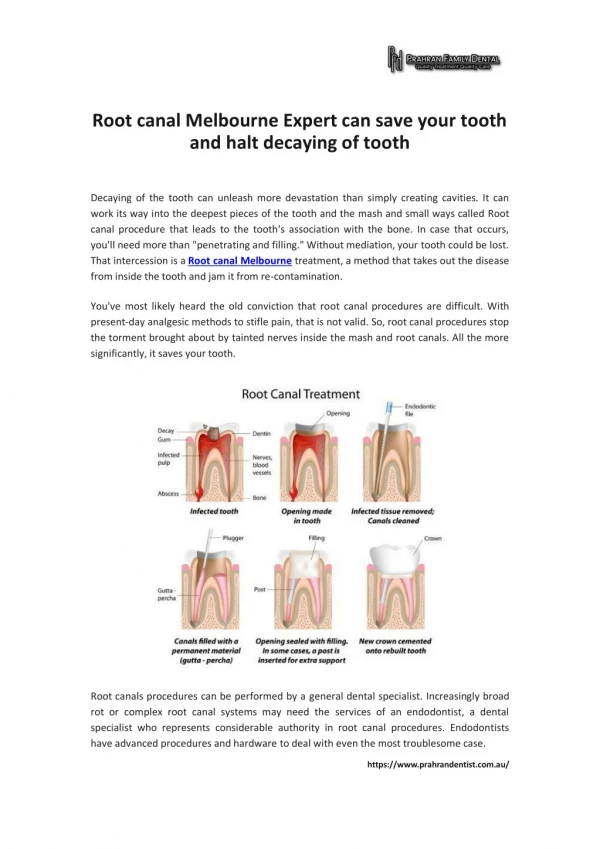 Root canal Melbourne Expert can save your tooth and halt decaying of tooth