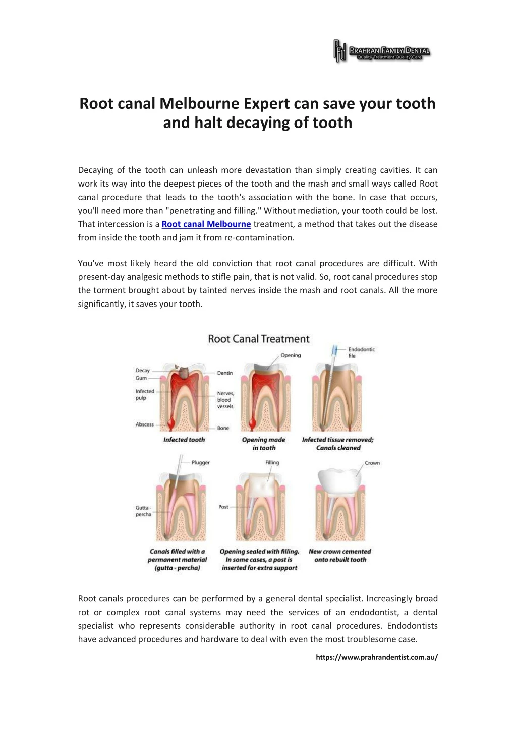 root canal melbourne expert can save your tooth