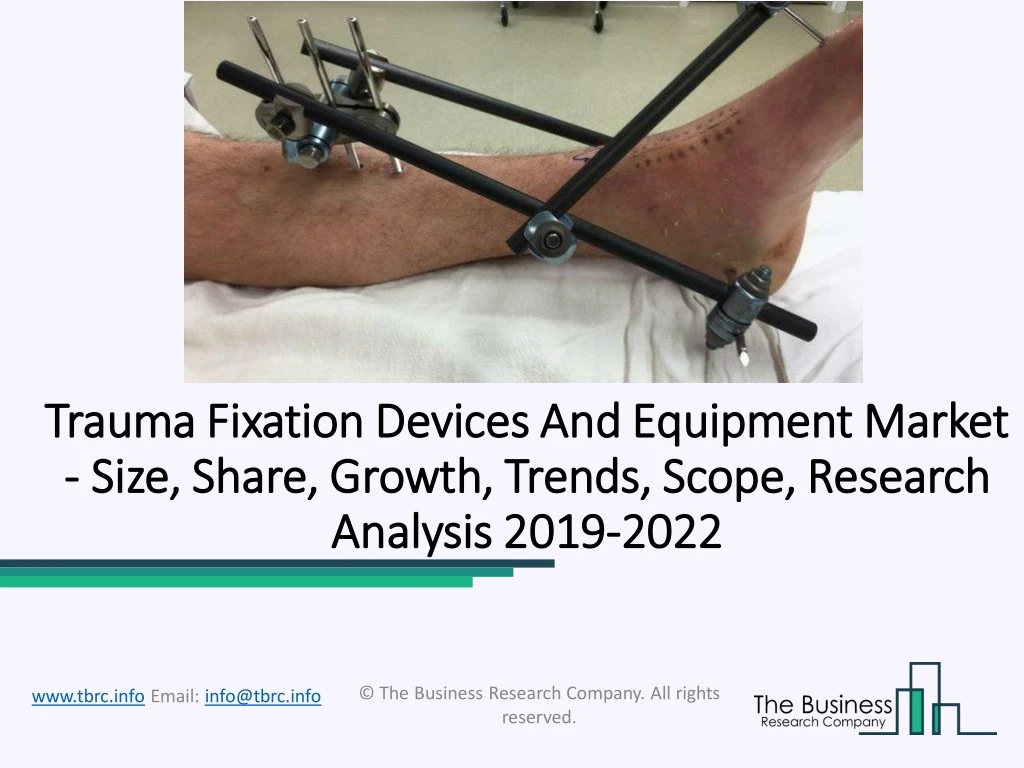 trauma fixation devices and equipment market