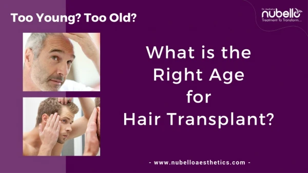 Too Young? Too Old? What is the Age for Hair Transplant?