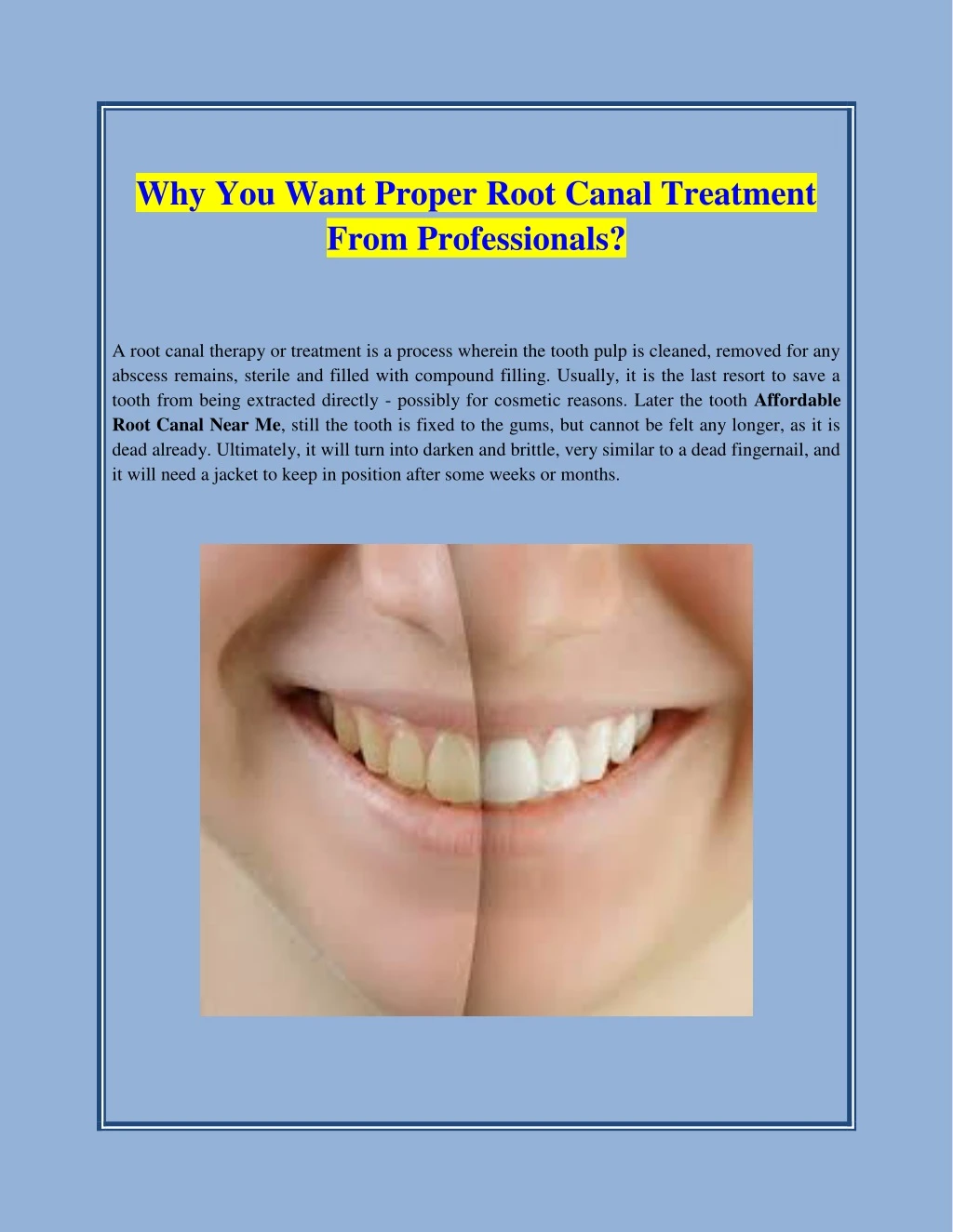 why you want proper root canal treatment from