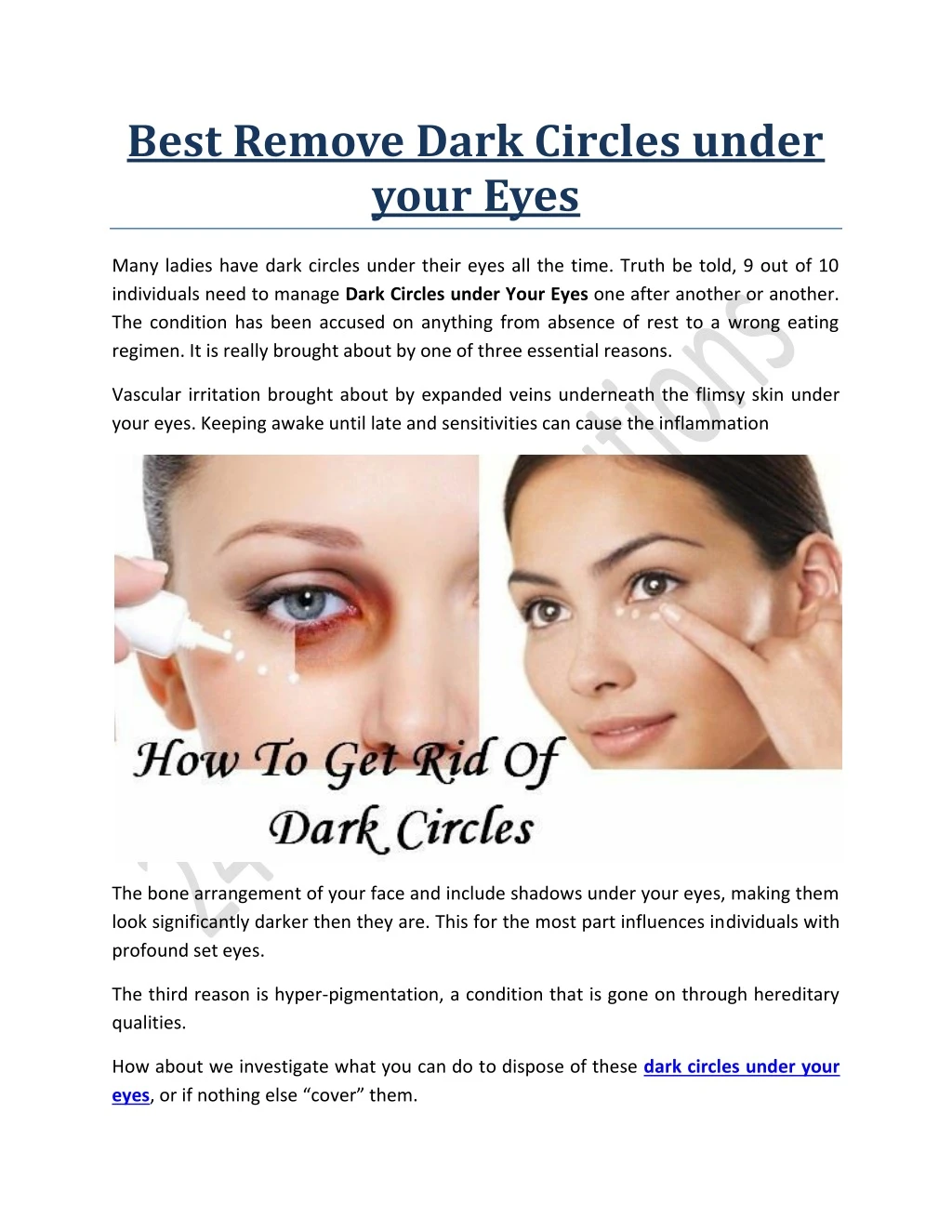 best remove dark circles under your eyes