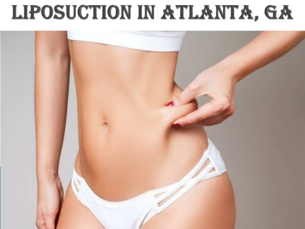 liposuction in atlanta ga