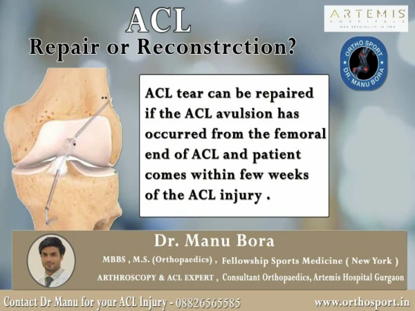 ACL Repair or Reconstrction in delhi Ncr