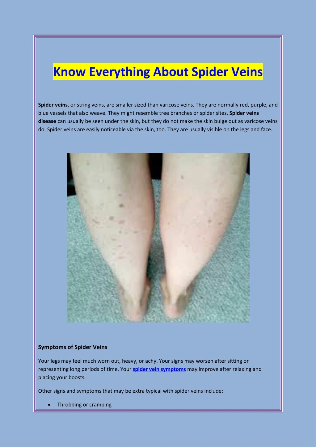 know everything about spider veins