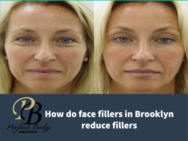 How do face fillers in Brooklyn reduce fillers