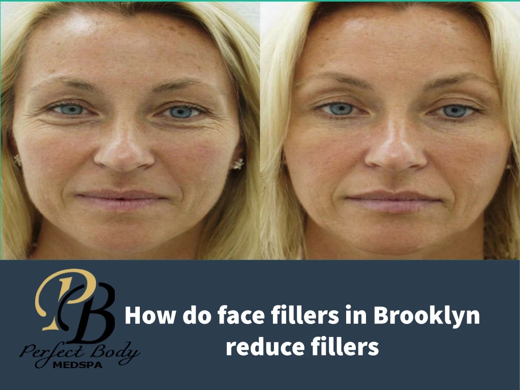 how do face fillers in brooklyn reduce fillers