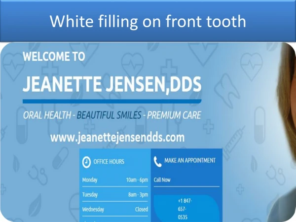 Tooth colored fillings