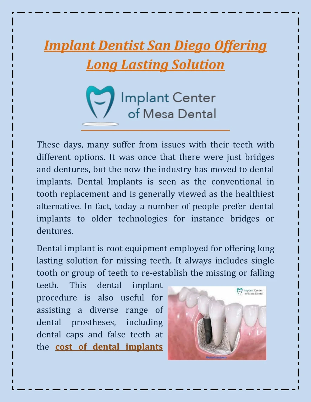 implant dentist san diego offering long lasting