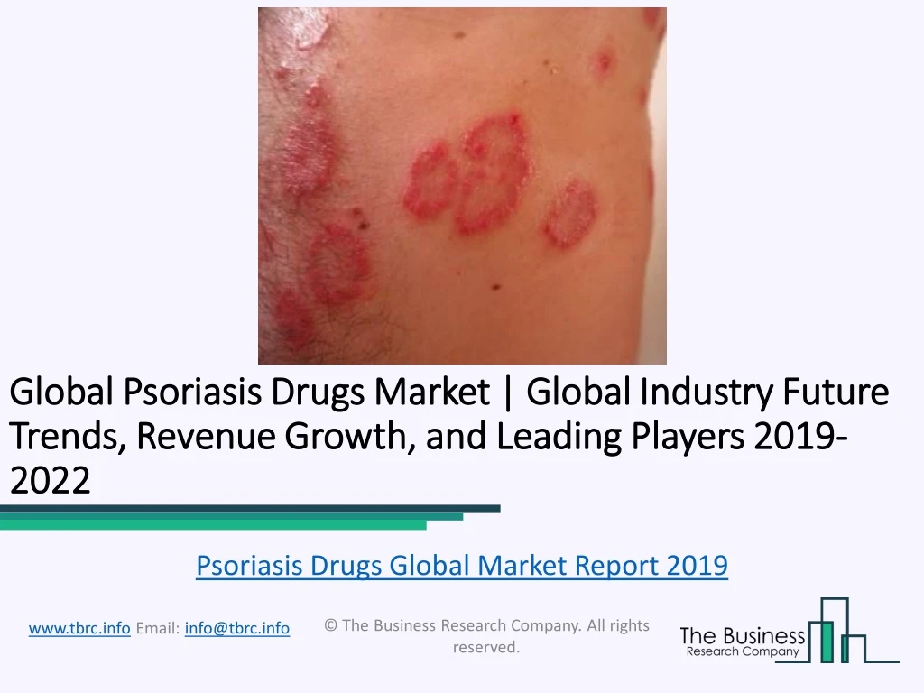 global global psoriasis drugs psoriasis drugs