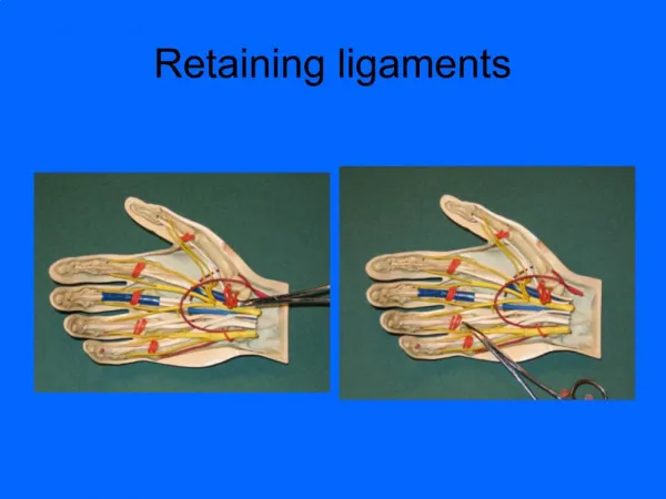 Retaining ligaments