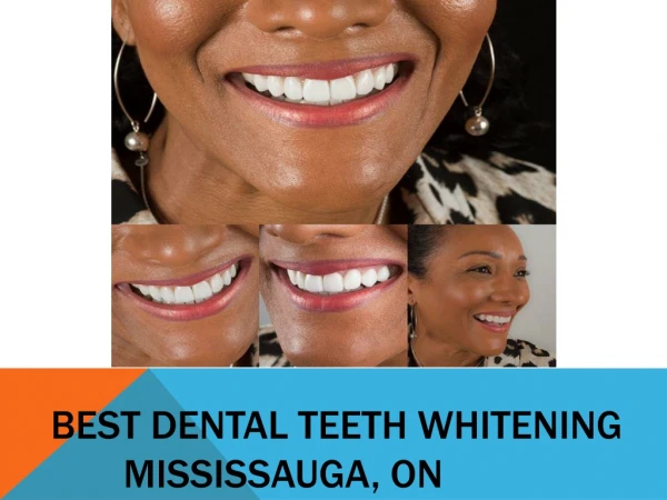 BEST DENTAL TEETH WHITENING MISSISSAUGA, ON