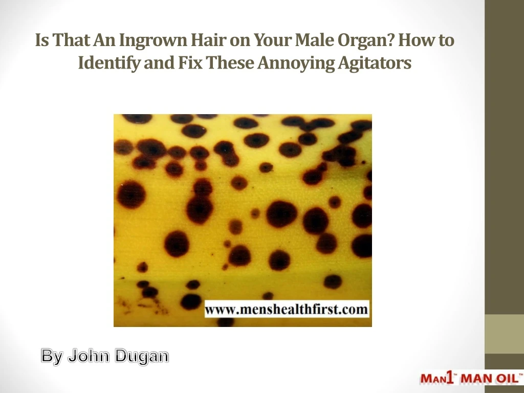 is that an ingrown hair on your male organ how to identify and fix these annoying agitators