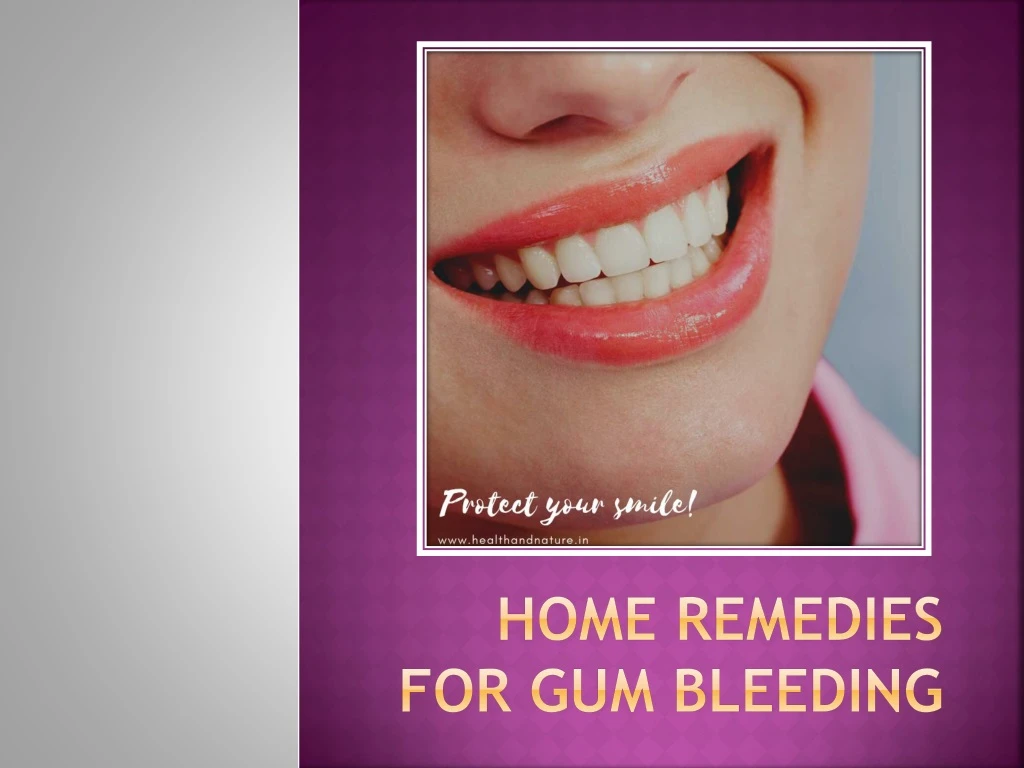 home remedies for gum bleeding