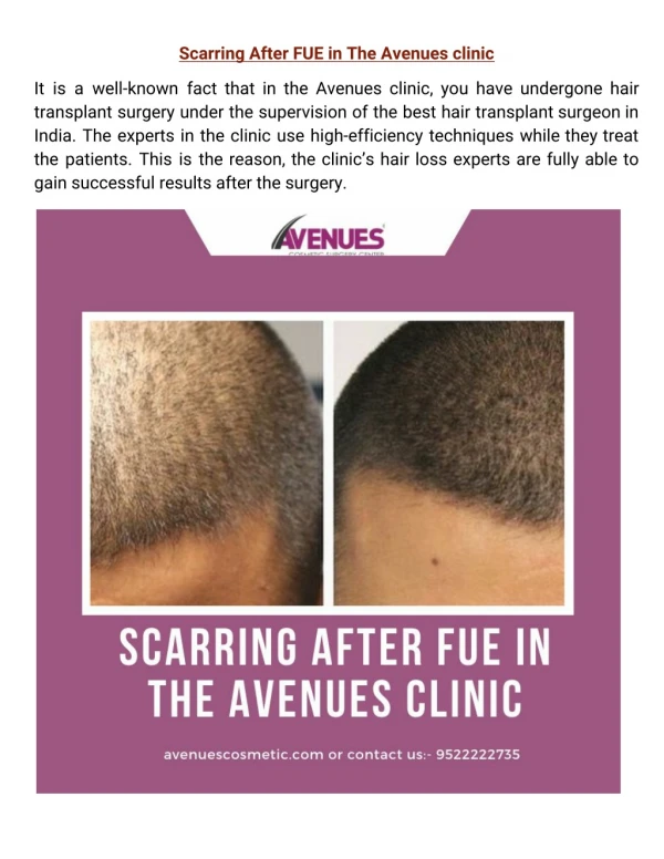 Scarring After FUE in The Avenues clinic