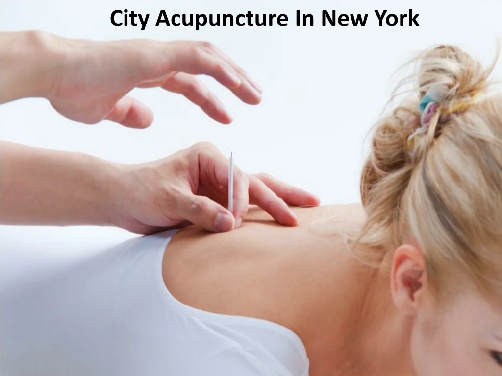 city acupuncture in new york