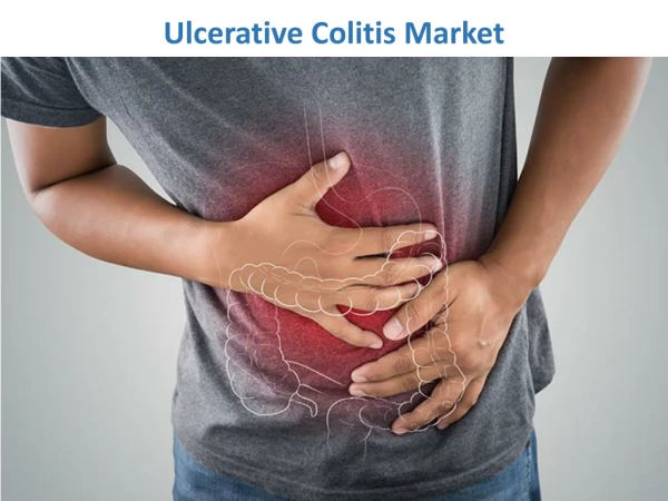 Ulcerative Colitis Market Expected to Reach $4,785 Million by 2023