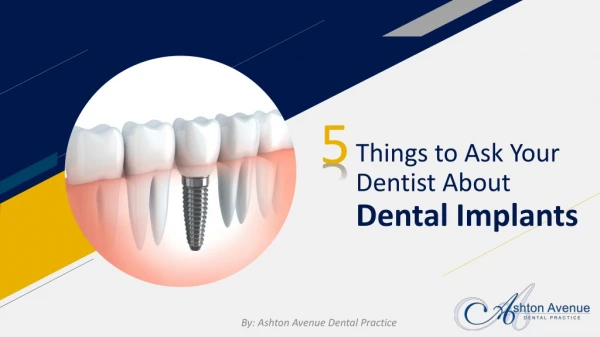 5 Things to Ask Your Dentist About Dental Implants