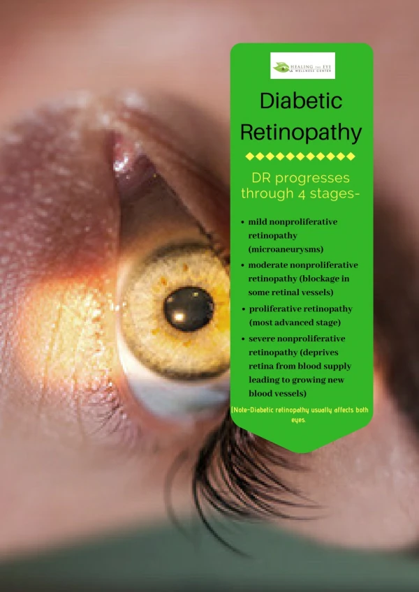 Diabetic Retinopathy & Its Effect on Eye Health