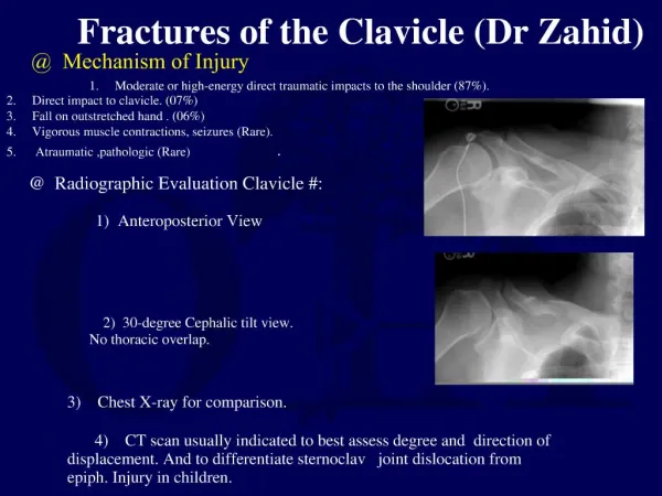 Mechanism of Injury