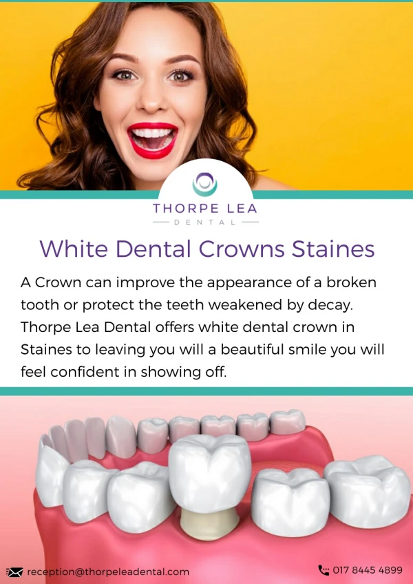 White Dental Crowns Staines