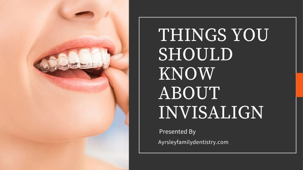 things you should know about invisalign presented