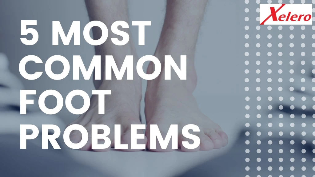 5 most common foot problems