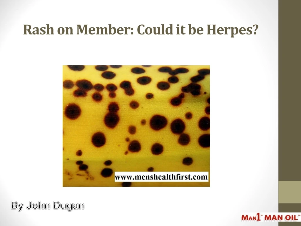 rash on member could it be herpes