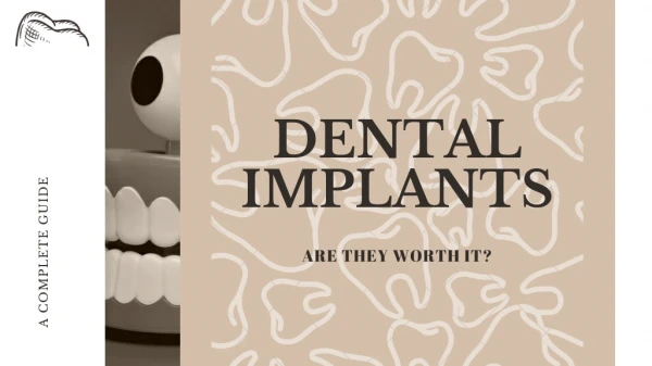 dental implants