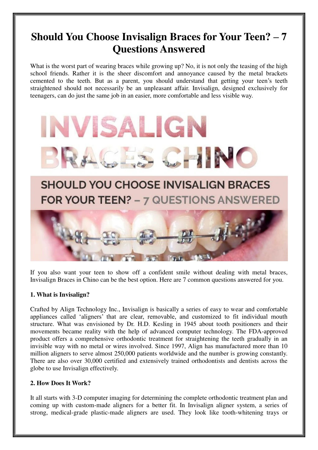 should you choose invisalign braces for your teen