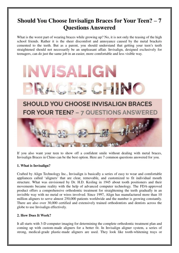 Should You Choose Invisalign Braces for Your Teen? – 7 Questions Answered